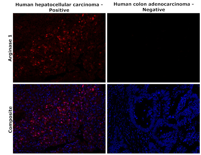 Arginase 1 Antibody