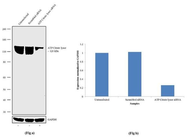 ATP Citrate Lyase Antibody in Western Blot (WB)