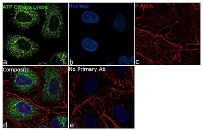 ATP Citrate Lyase Antibody in Immunocytochemistry (ICC/IF)