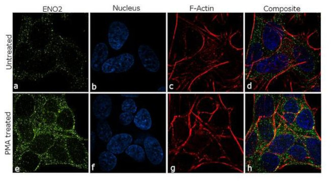 NSE Antibody in Immunocytochemistry (ICC/IF)