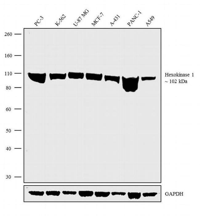 HK1 Antibody in Western Blot (WB)