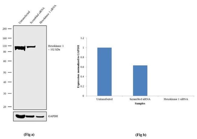 HK1 Antibody in Western Blot (WB)