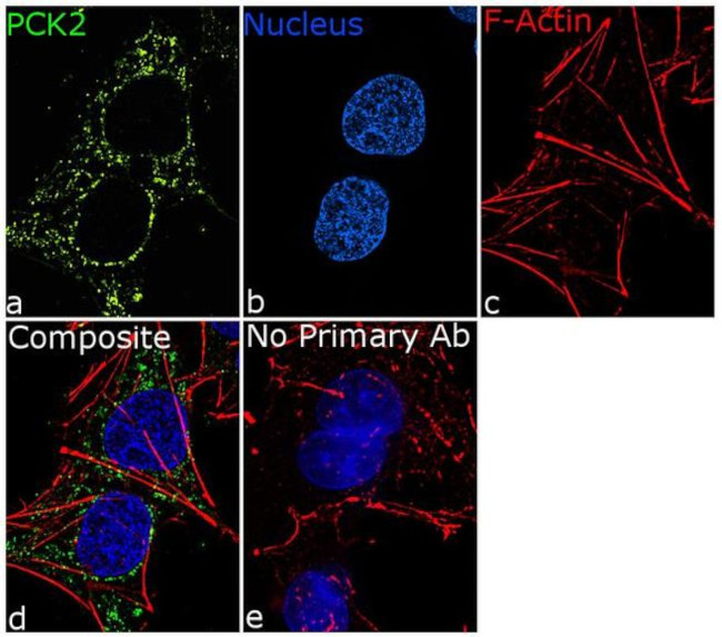 PCK2 Antibody in Immunocytochemistry (ICC/IF)