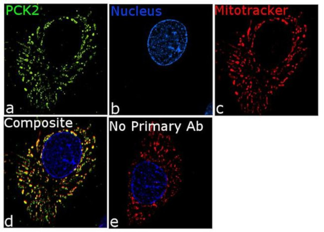 PCK2 Antibody in Immunocytochemistry (ICC/IF)