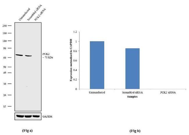 PCK2 Antibody in Western Blot (WB)