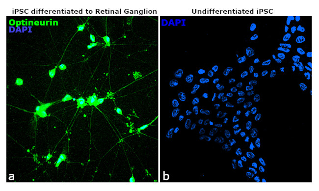 Optineurin Antibody in Immunocytochemistry (ICC/IF)