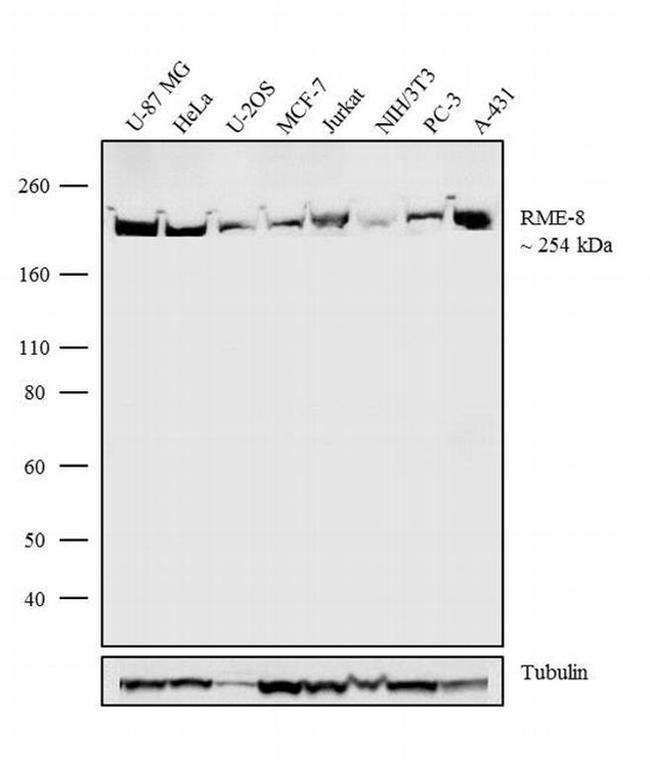 DNAJC13 Antibody in Western Blot (WB)