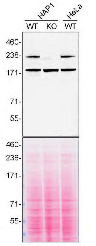 SPG11 Antibody in Western Blot (WB)