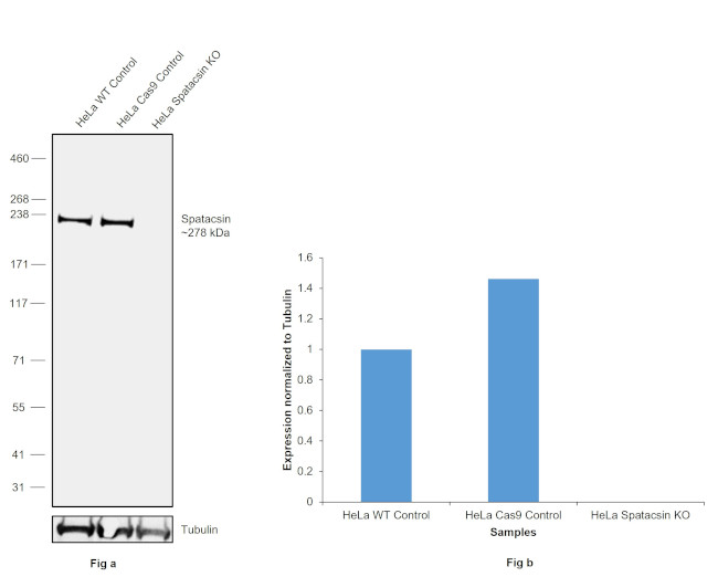 SPG11 Antibody in Western Blot (WB)