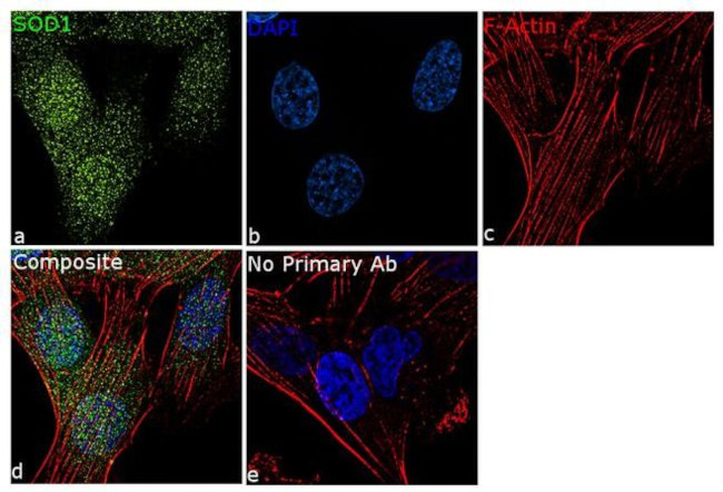 SOD1 Antibody in Immunocytochemistry (ICC/IF)