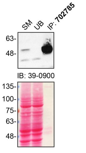 Parkin Antibody in Immunoprecipitation (IP)