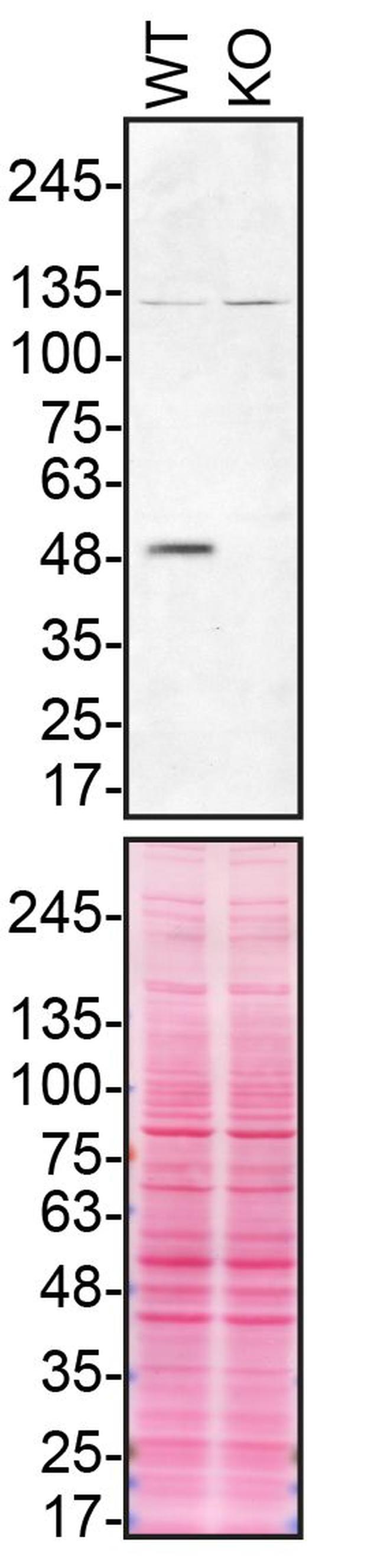 Parkin Antibody in Western Blot (WB)