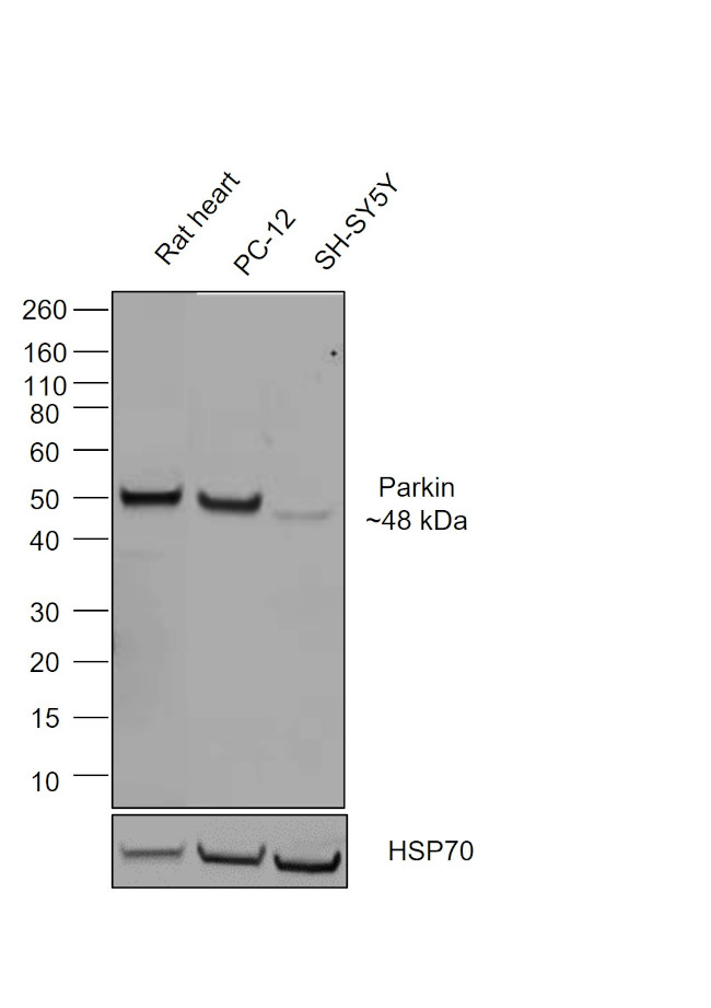 Parkin Chimeric Antibody in Western Blot (WB)