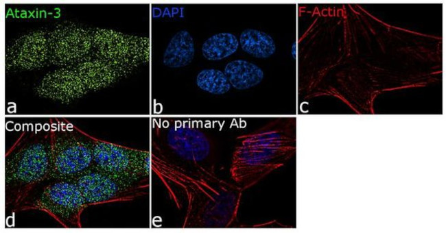 Ataxin 3 Antibody in Immunocytochemistry (ICC/IF)