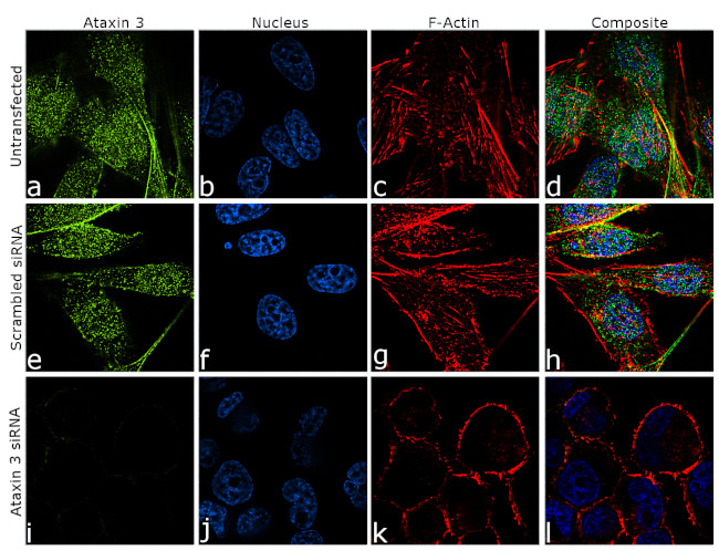 Ataxin 3 Antibody in Immunocytochemistry (ICC/IF)