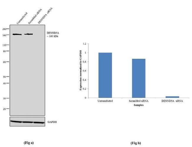 DENND5A Antibody in Western Blot (WB)