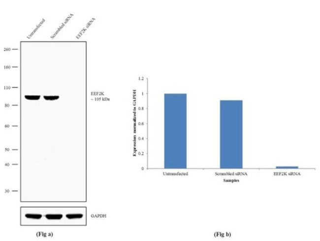 EEF2K Antibody