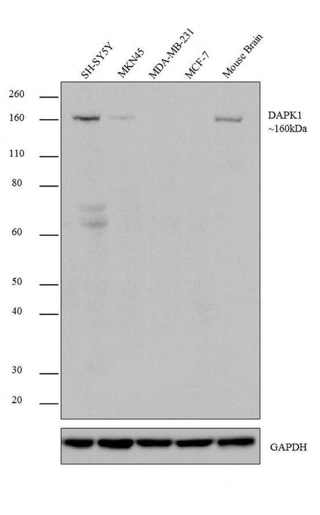 DAPK1 Antibody in Western Blot (WB)