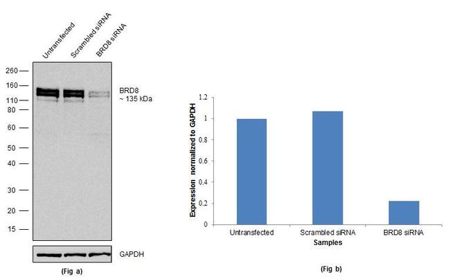 BRD8 Antibody in Western Blot (WB)