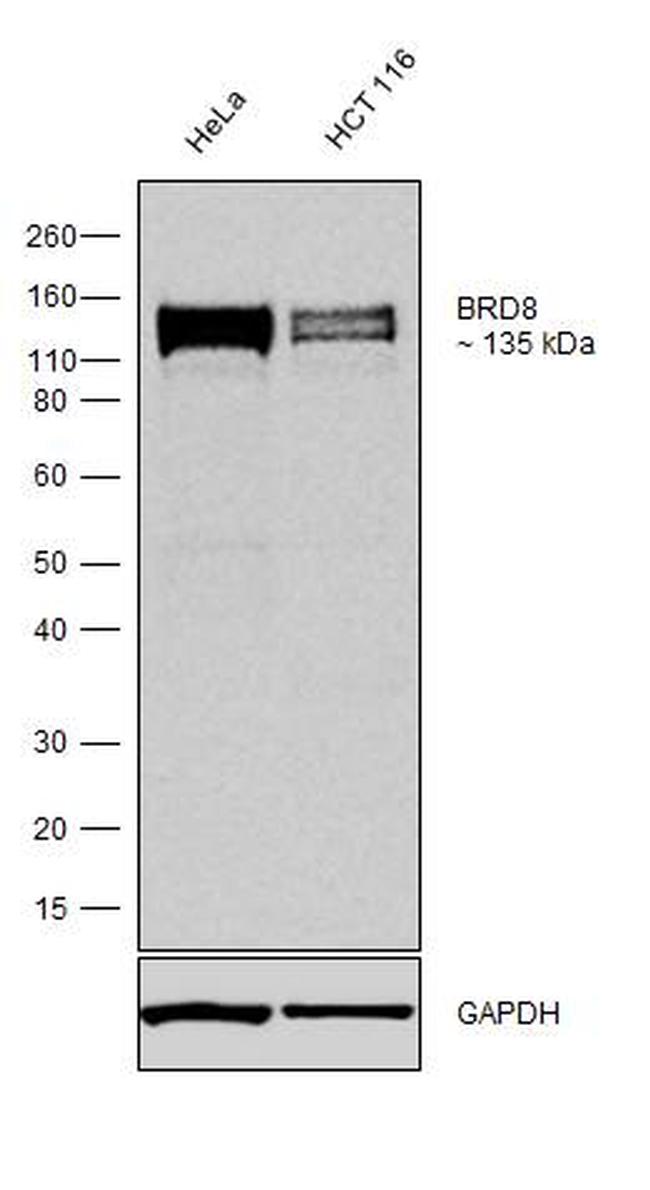 BRD8 Antibody in Western Blot (WB)