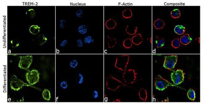 TREM2 Antibody