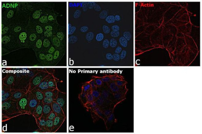 ADNP Antibody in Immunocytochemistry (ICC/IF)