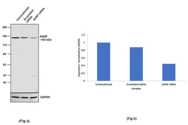 ADNP Antibody