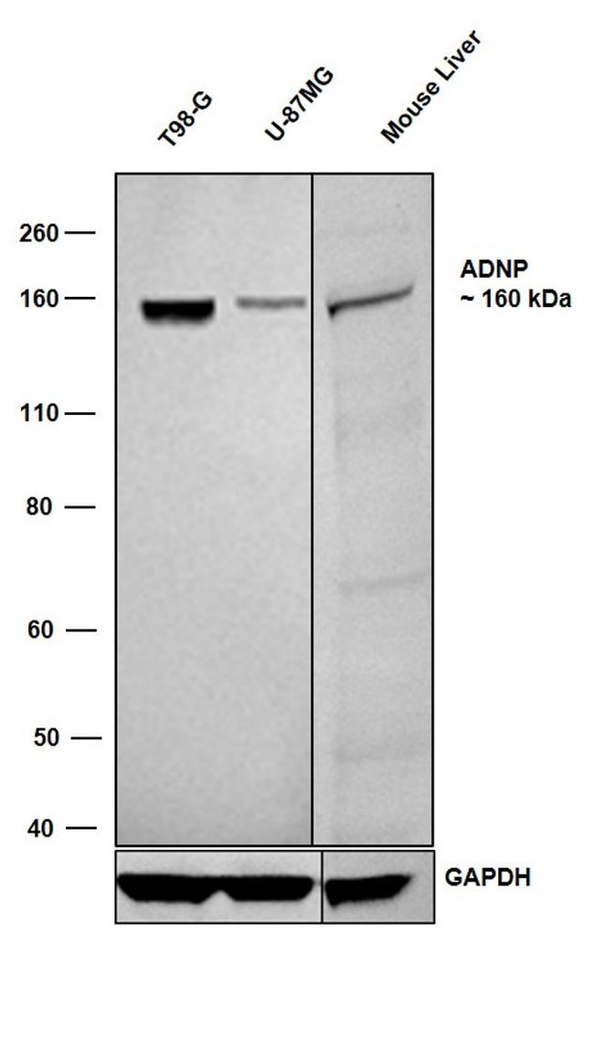 ADNP Antibody in Western Blot (WB)