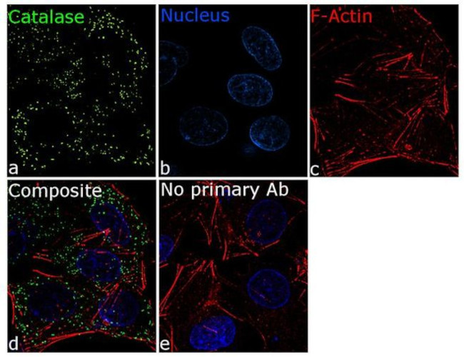 Catalase Antibody in Immunocytochemistry (ICC/IF)