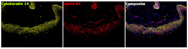 Lamin B1 Antibody in Immunohistochemistry (Paraffin) (IHC (P))