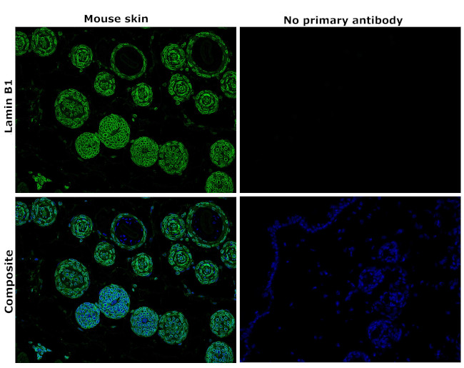 Lamin B1 Antibody in Immunohistochemistry (Paraffin) (IHC (P))