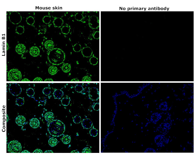 Lamin B1 Antibody in Immunohistochemistry (Paraffin) (IHC (P))