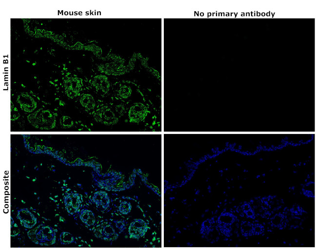 Lamin B1 Antibody in Immunohistochemistry (Paraffin) (IHC (P))