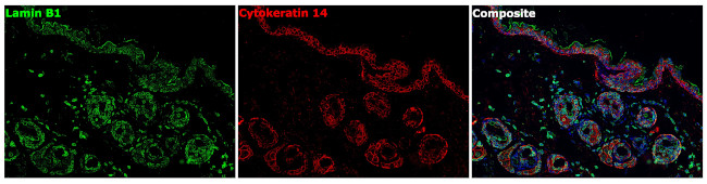 Lamin B1 Antibody in Immunohistochemistry (Paraffin) (IHC (P))