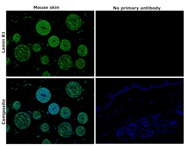 Lamin B1 Antibody in Immunohistochemistry (Paraffin) (IHC (P))