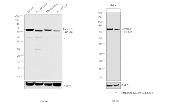 Lamin B1 Antibody in Western Blot (WB)