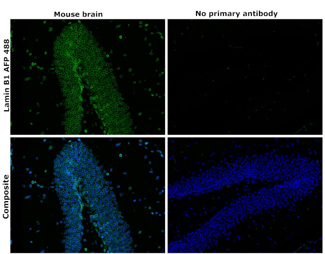 Lamin B1 Antibody in Immunohistochemistry (Paraffin) (IHC (P))