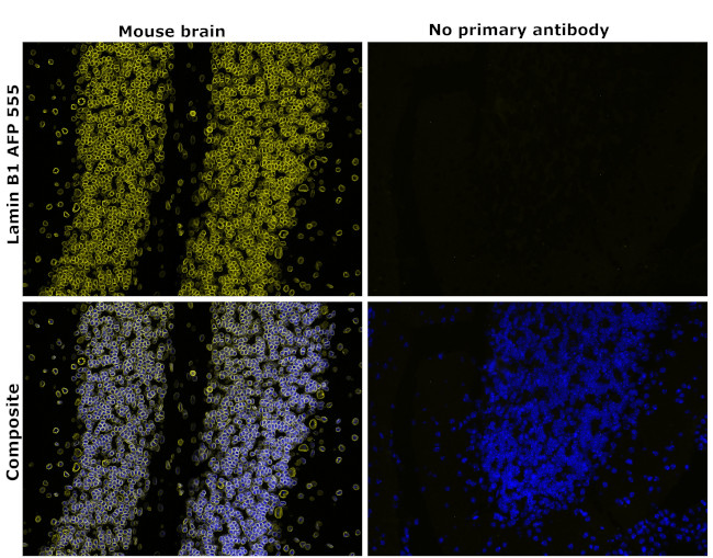 Lamin B1 Antibody in Immunohistochemistry (Paraffin) (IHC (P))