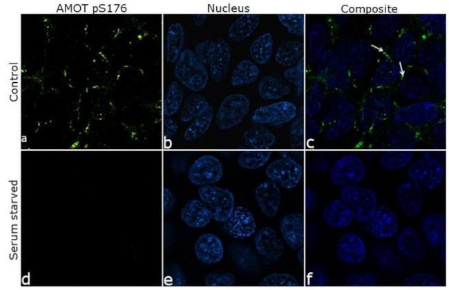 Phospho-AMOT (Ser175) Antibody in Immunocytochemistry (ICC/IF)