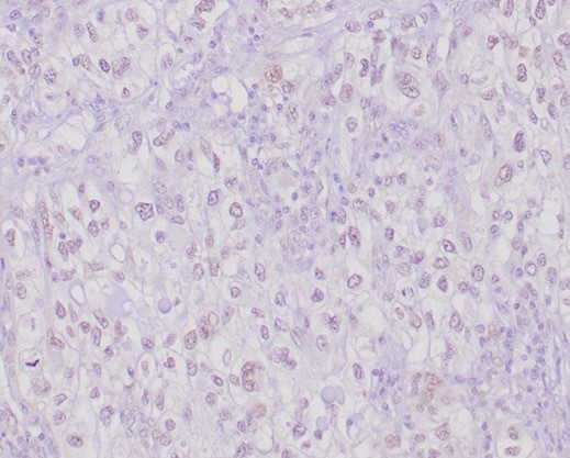 Transcription factor E3/TFE3 (Transcription Factor) Antibody in Immunohistochemistry (Paraffin) (IHC (P))