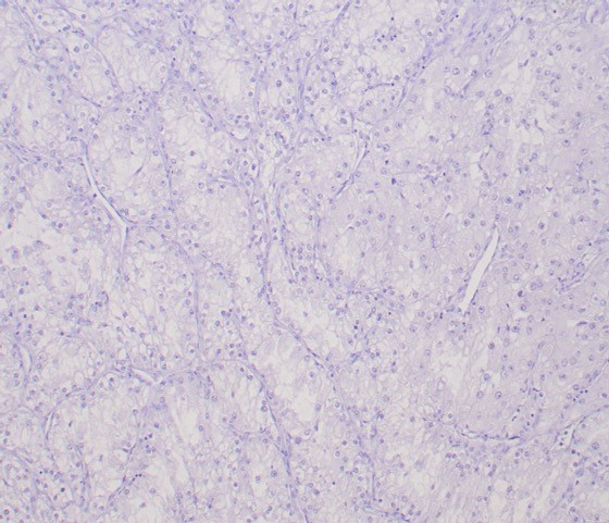 Transcription factor E3/TFE3 (Transcription Factor) Antibody in Immunohistochemistry (Paraffin) (IHC (P))