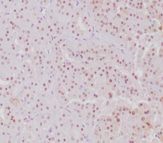 Transcription factor E3/TFE3 (Transcription Factor) Antibody in Immunohistochemistry (Paraffin) (IHC (P))