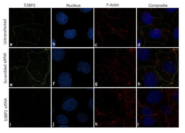 53BP2 Antibody