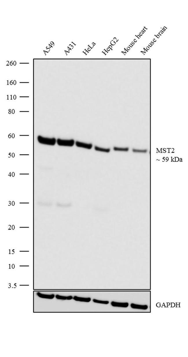 MST2 Antibody in Western Blot (WB)