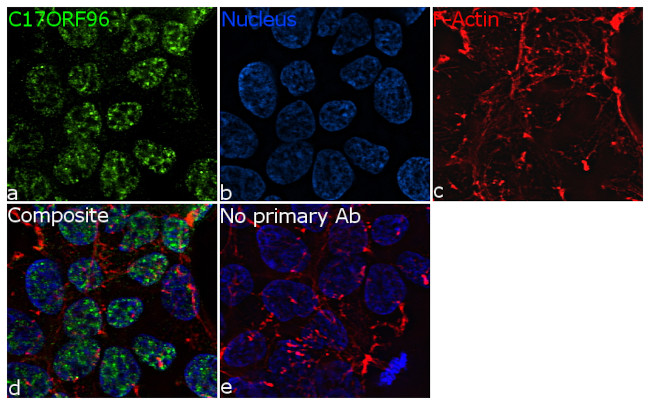 C17orf96 Antibody in Immunocytochemistry (ICC/IF)