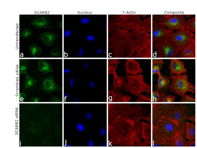 LIMP2 Antibody in Immunocytochemistry (ICC/IF)