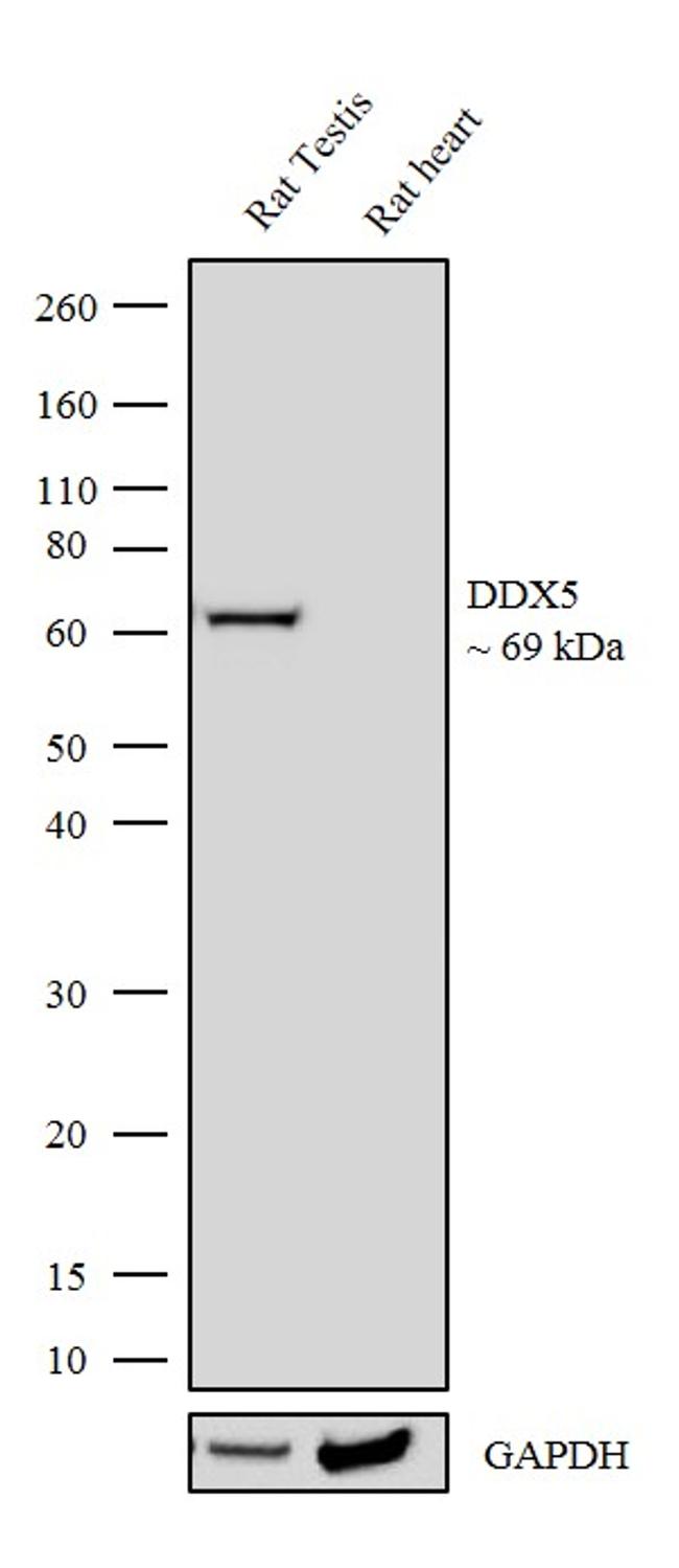 DDX5 Antibody in Western Blot (WB)