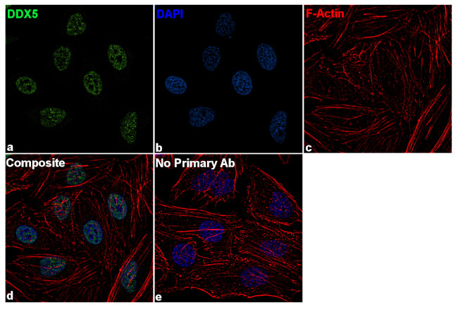 DDX5 Antibody in Immunocytochemistry (ICC/IF)