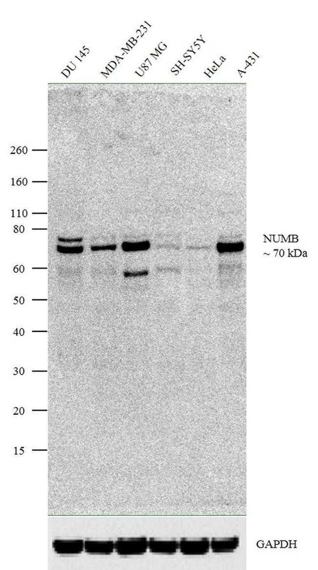 NUMB Antibody in Western Blot (WB)