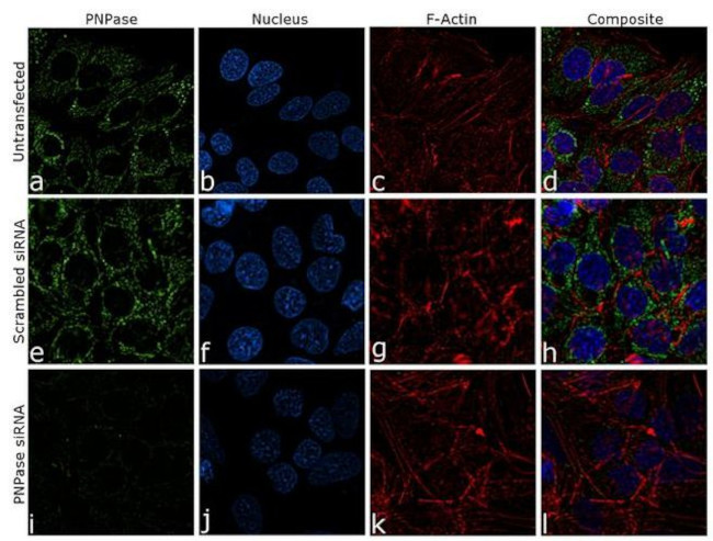 PNPase Antibody in Immunocytochemistry (ICC/IF)